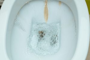limescale deposits on toilet